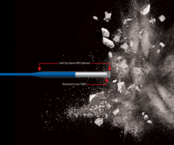 Fibre laser ScopeSafe